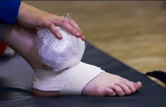 Chườm lạnh chữa chấn thương