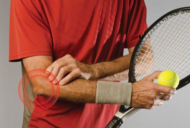 Hội chứng Tennis Elbow - Đau khuỷu tay do đánh Tennis