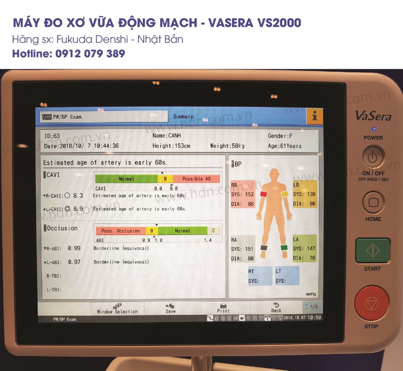 Huyết áp cao gây xơ vữa động mạch 8