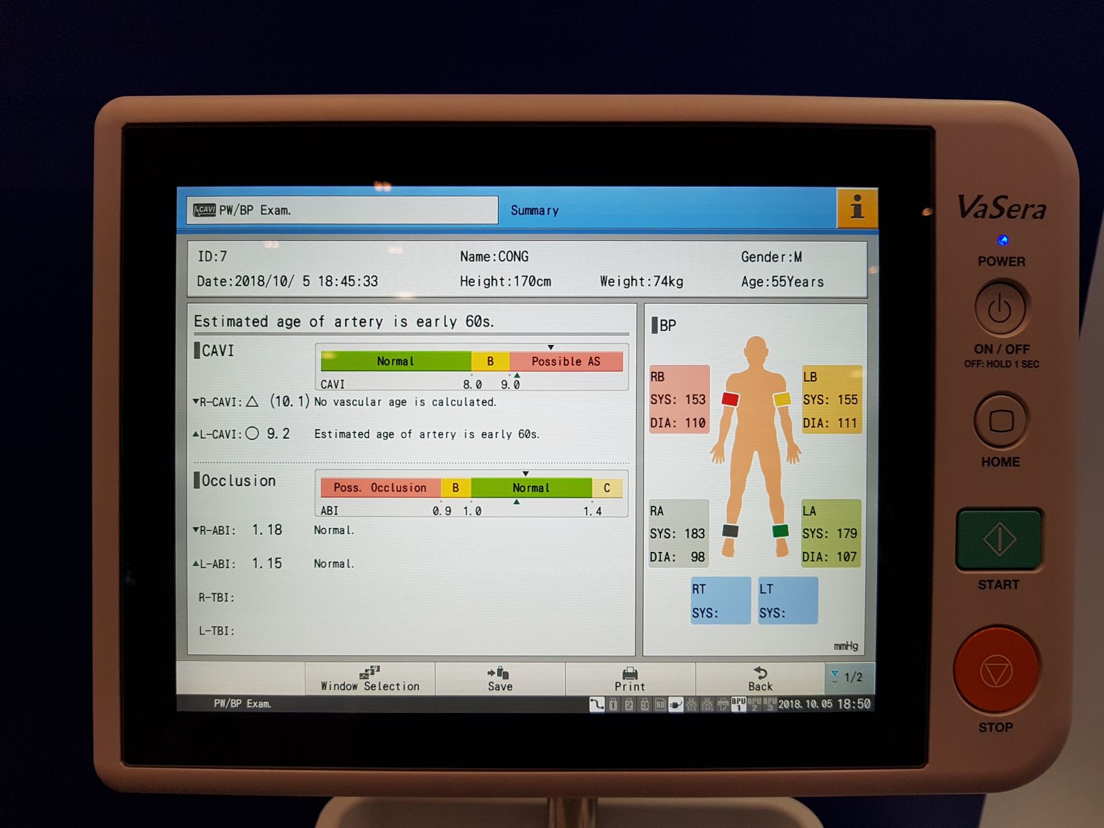 Thiết bị mới cho việc chẩn đoán bệnh xơ vữa động mạch Vasera VS-2000 3