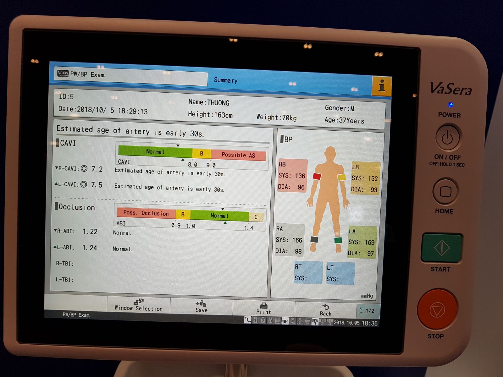Thiết bị mới cho việc chẩn đoán bệnh xơ vữa động mạch Vasera VS-2000 5