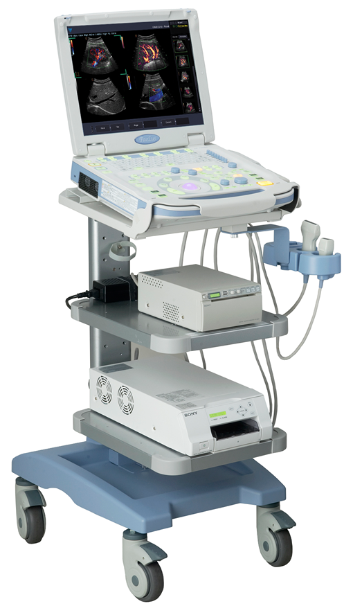 Tư vấn cách chọn máy siêu âm 1