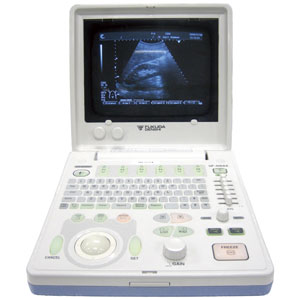 Tư vấn cách chọn máy siêu âm 2