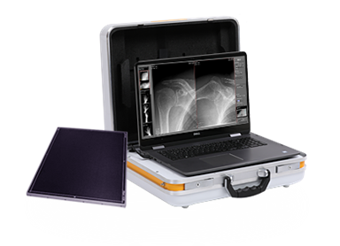 Hệ thống X-Quang xách tay kỹ thuật số