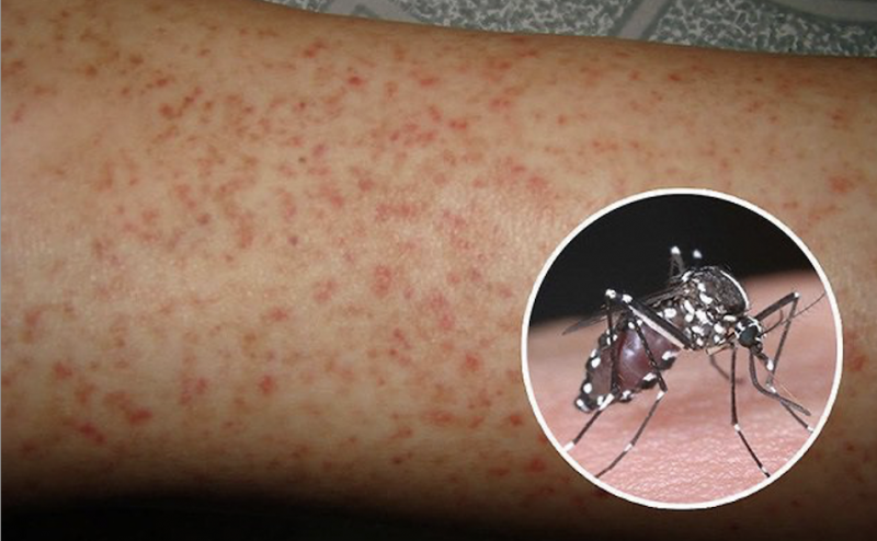 Nguy cơ bùng phát dịch sốt xuất huyết ở Hà Nội