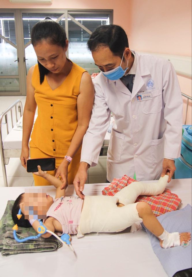 Trật khớp háng bẩm sinh ở trẻ, dị tật cần phát hiện sớm 1