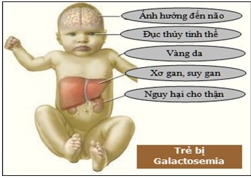 Sàng lọc sơ sinh - Bảo vệ bé yêu từ những khoảnh khắc đầu đời 5